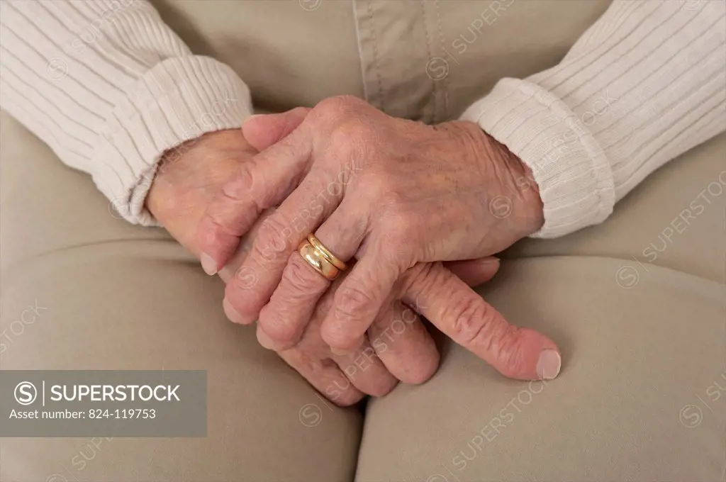 poly arthritis hand senior woman