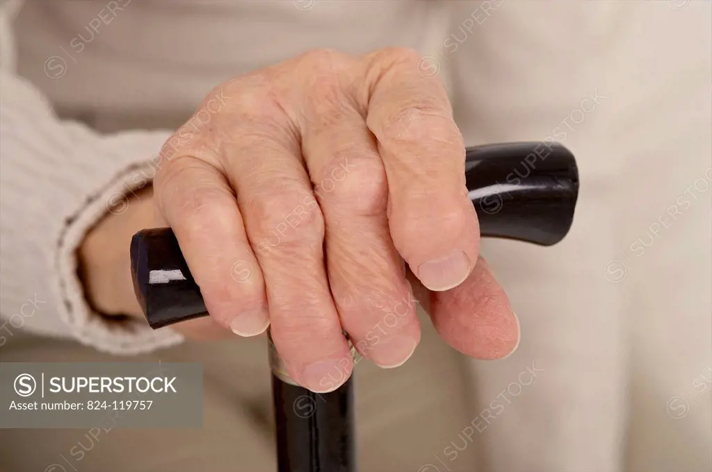 poly arthritis hand senior woman