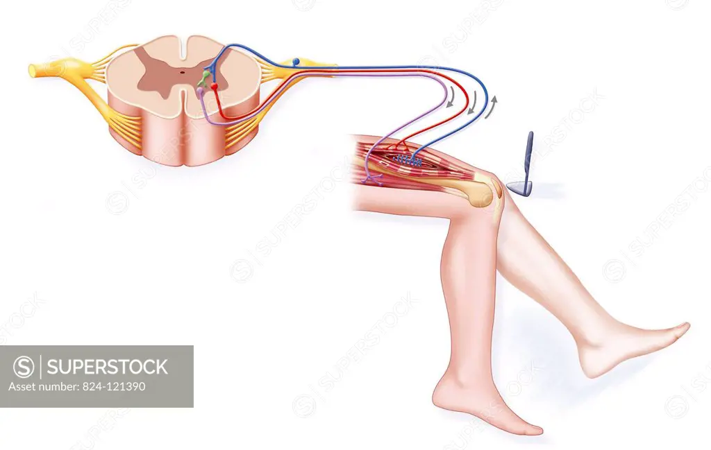 Illustration showing the parts of the body involved in a patellar reflex. The afferent impulse (blue) goes from the muscle to the bone marrow through ...