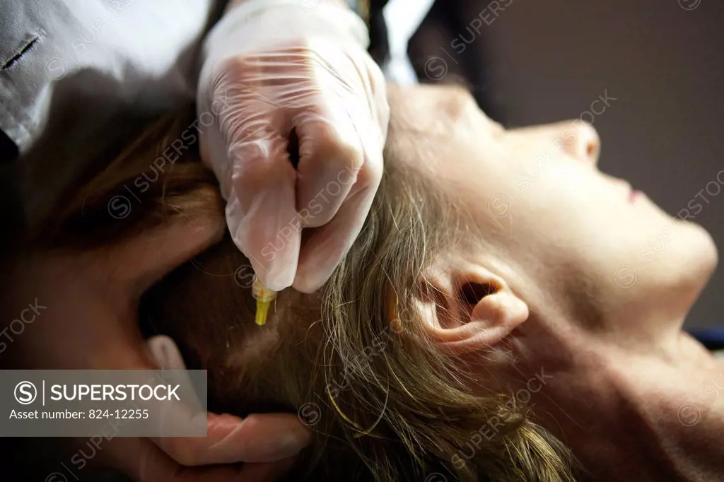 Photo essay in a aesthetic medicine office France. Hair and scalp treatment by carboxytherapy. Carboxytherapy is a simple technique in which carbon di...