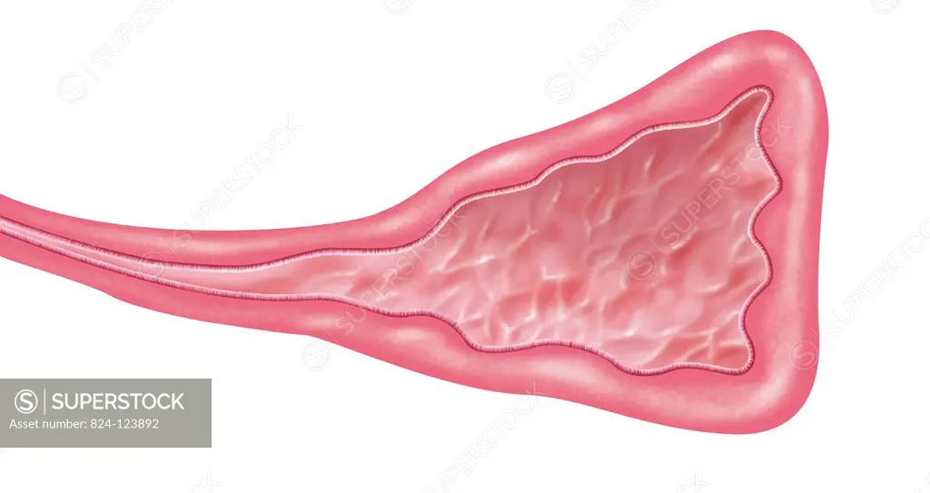 A cross-section illustration of the sinus mucous membrane, with the layer of cilia that line the sinus.