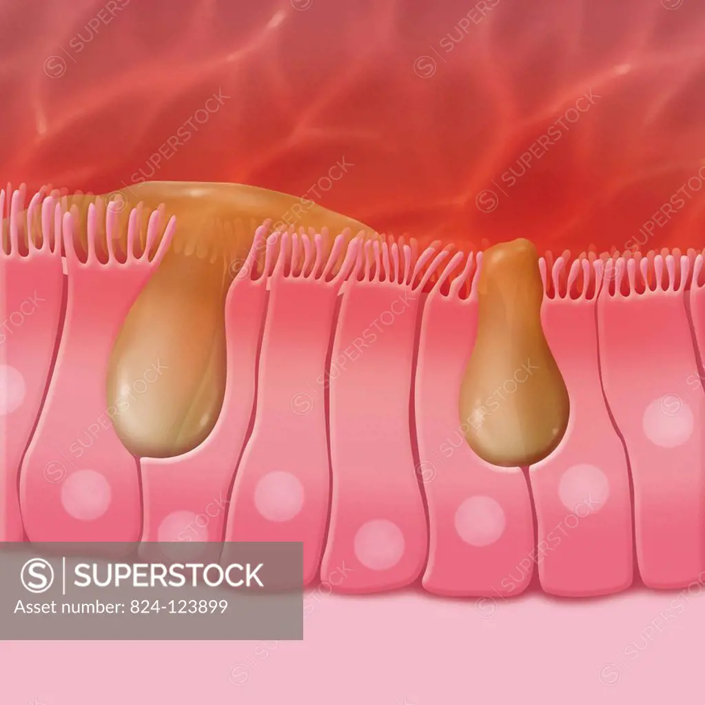 Illustration of the ciliated cells of the sinus. These cells drain mucus that traps external particles. In the case of sinusitis, the ciliated cells d...