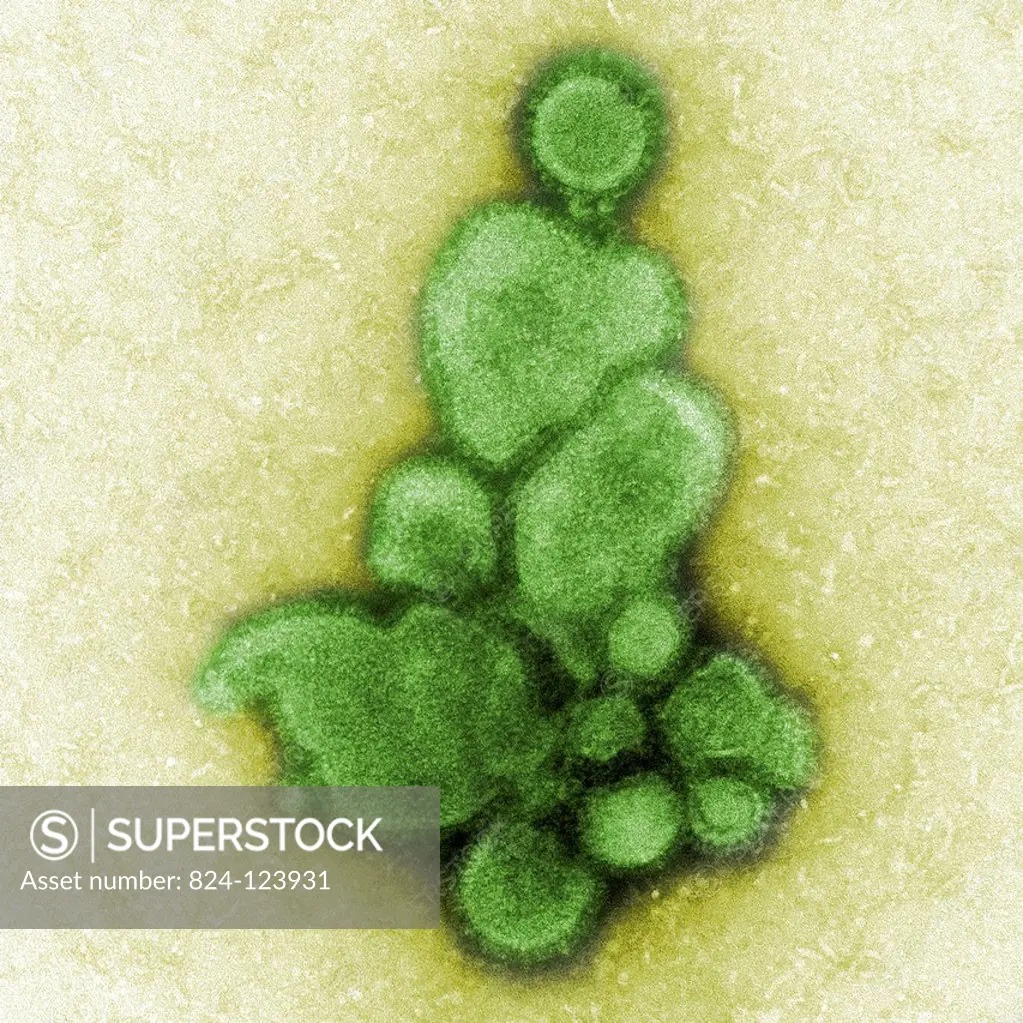 This negatively-stained transmission electron micrograph (TEM) captured some of the ultrastructural details exhibited by the new influenza A (H7N9) vi...