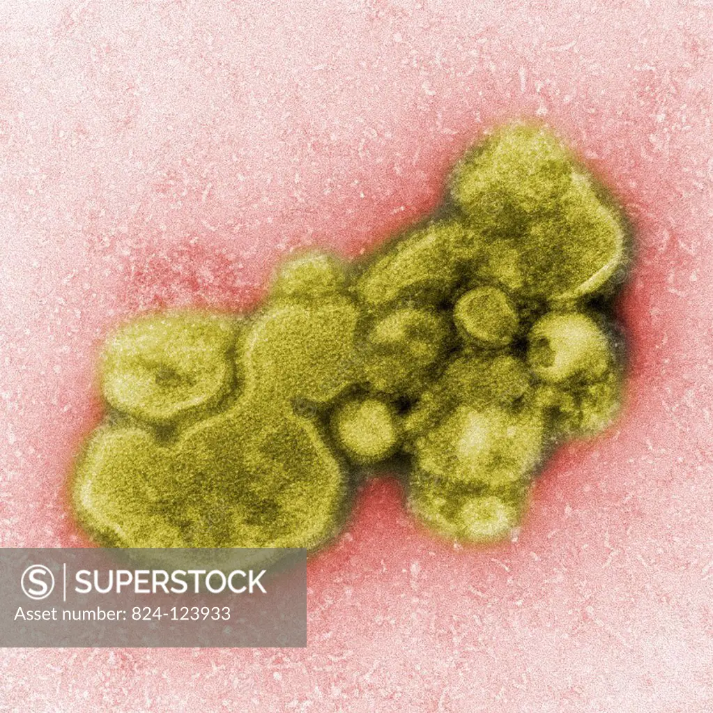 This negatively-stained transmission electron micrograph (TEM) captured some of the ultrastructural details exhibited by the new influenza A (H7N9) vi...