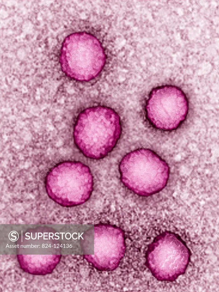 Bunyavirus. Image produced using high-dynamic-range imaging (HDRI) from an image taken with transmission electron microscopy. Viral diameter around 10...