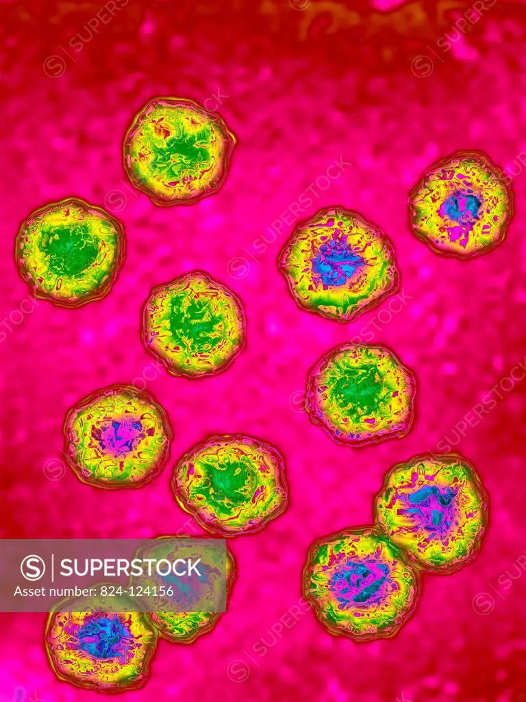 Hepatitis D virus (HDV). Image produced using high-dynamic-range imaging (HDRI) from an image taken with transmission electron microscopy. Viral diame...