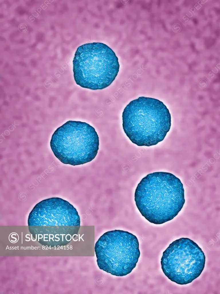 Hepatitis E virus (HEV). Image produced using high-dynamic-range imaging (HDRI) from an image taken with transmission electron microscopy. Viral diame...