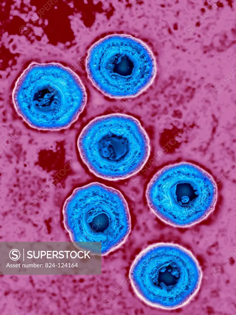 Herpes virus (HSV 1 & 2). Image produced using high-dynamic-range imaging (HDRI) from an image taken with transmission electron microscopy. Viral diam...