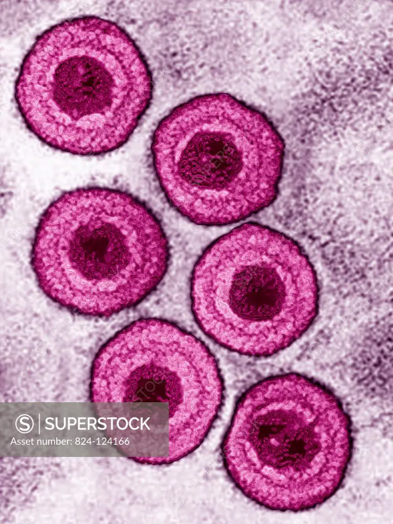 Varicella zoster virus (human herpesvirus type 3, HHV-3). It causes chicken pox and shingles (herpes zoster). Image produced using high-dynamic-range ...