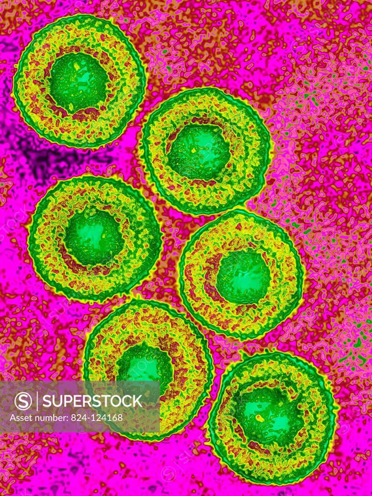 Varicella zoster virus (human herpesvirus type 3, HHV-3). It causes chicken pox and shingles (herpes zoster). Image produced using high-dynamic-range ...