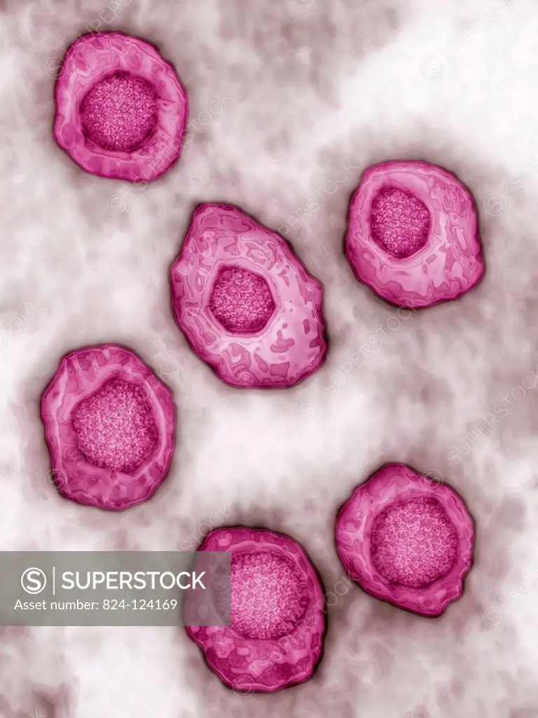 Epstein-Barr virus (human herpesvirus type 4, HHV-4). It causes infectious mononucleosis (glandular fever) and Burkitt's lymphona. Image produced usin...