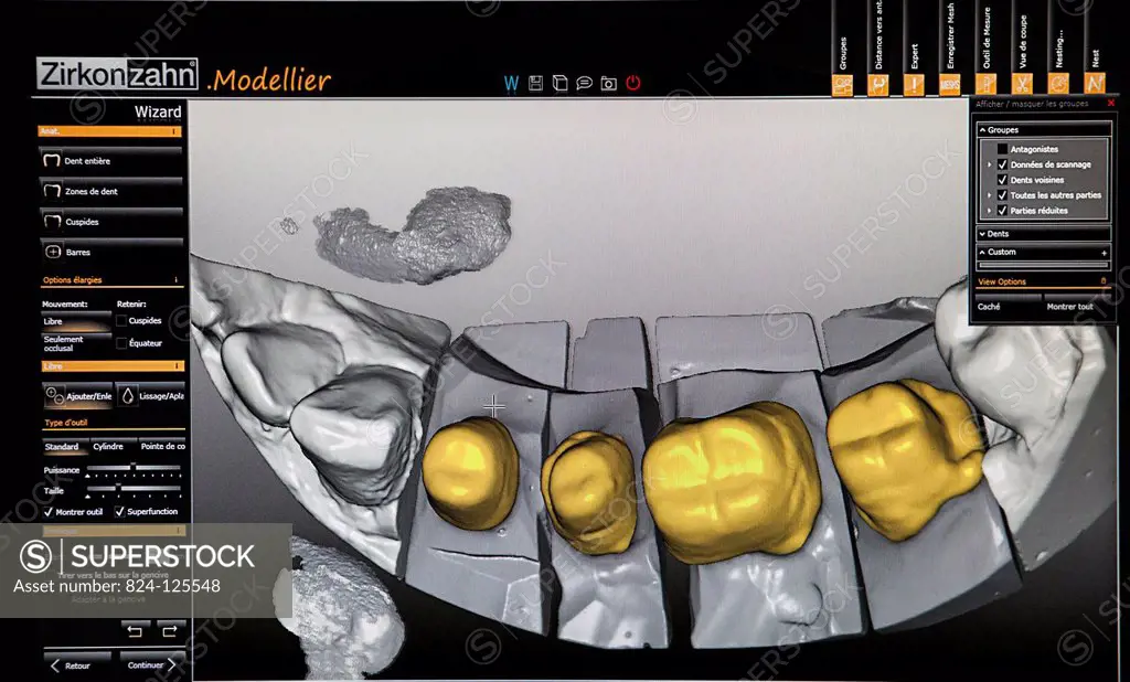 Reportage in a dental prosthesis production lab which uses a system of computer-aided design and manufacturing (CAD/CAM) and is equipped with a Zirkon...