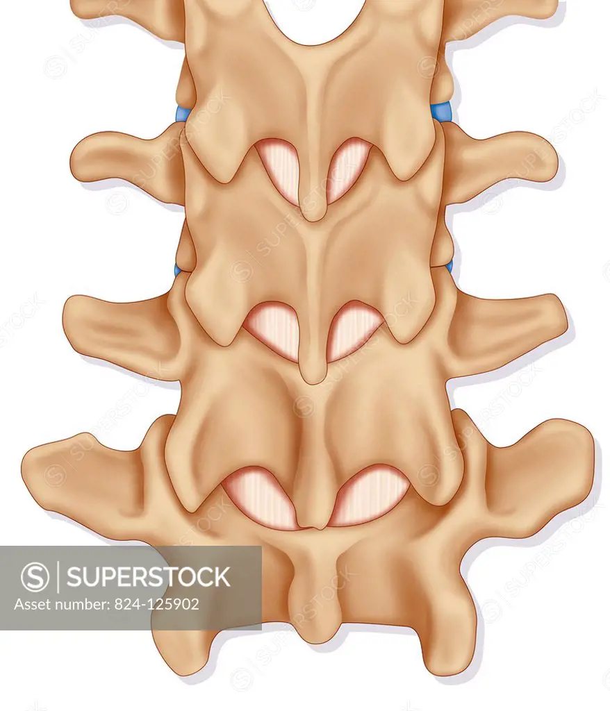 Illustration of the lumbar spine from L2 to L5, posterior view with the yellow ligament highlighted.