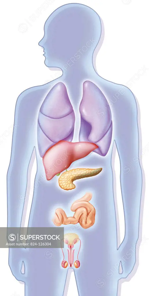 Illustration of cystic fibrosis. It is characterised by thick, viscous mucus that prevents the digestive and respiratory tracts from functioning norma...