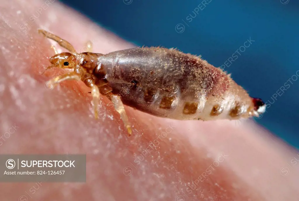 This 2006 photograph depicted a lateral view of a female body louse, Pediculus humanus var. corporis, as it was obtaining a blood-meal from a human ho...