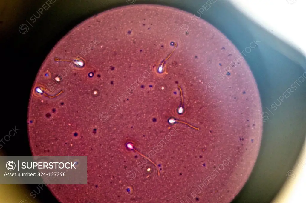 Reportage in the Medically Assisted Procreation (MAP) service in Antoine-Béclère hospital in France. IVF (In Vitro Fertilisation). Analysing sperm.