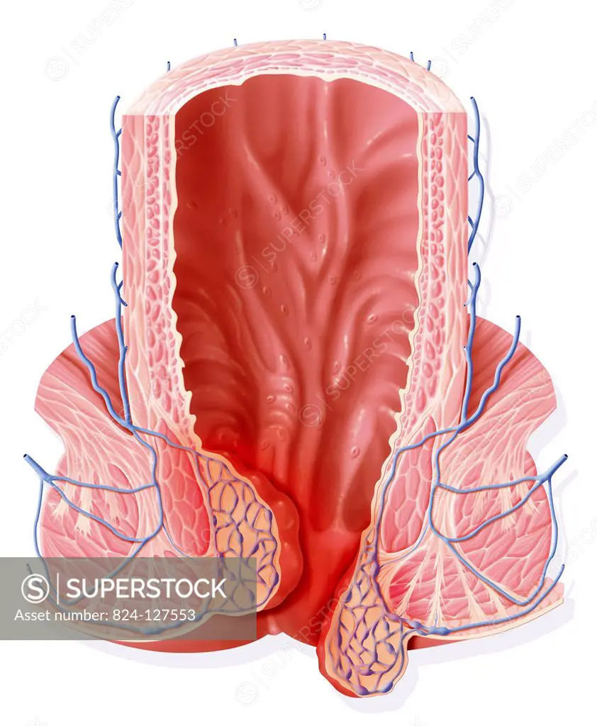 Illustration of the rectum, with the internal and external hemorrhoidal plexus.