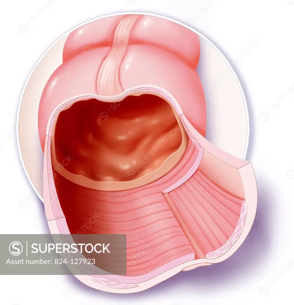 Illustration of the various layers of the colon. From the exterior to the interior : - the serosal layer - the muscle layer - the mucous layer