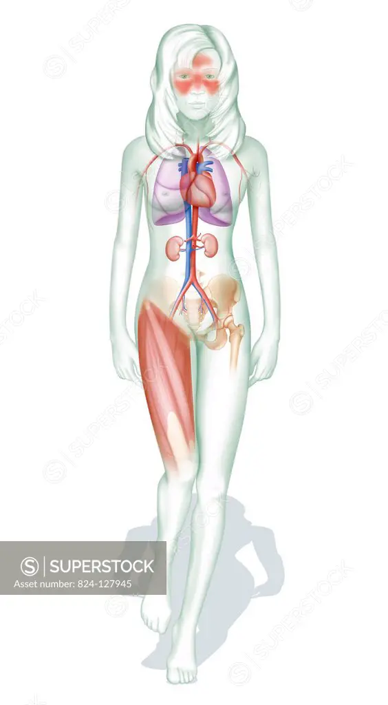 Illustration of organs affected by systemic lupus erythematosus. Lupus is a chronic auto-immune disease that can affect any part of the body. The name...