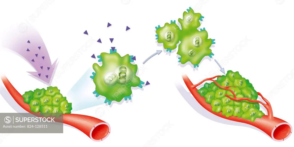 Illustration of the formation of a hormonodependent tumour. Tumour growth is stimulated by hormones : tumour cells have an abnormal quantity of specif...