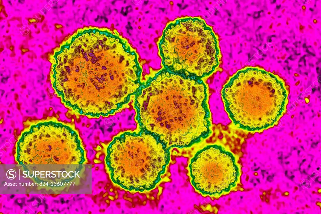 Rubella virus (rubivirus from the Togaviridae family). Image taken with transmission electron microscopy, (viral diameter around 50 to 70 nm).