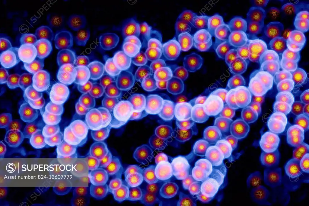 Streptococcus (Streptococcus pyogenes). Image taken from a microscope.