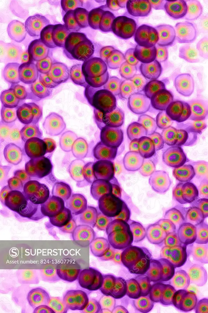 Streptococcus (Streptococcus pyogenes). Image taken from a microscope.