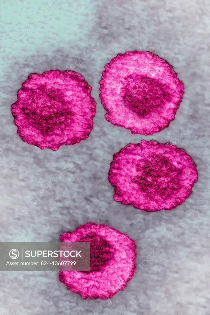 Varicella zoster virus (VZV or HHV 3). Image taken with transmission electron microscopy.