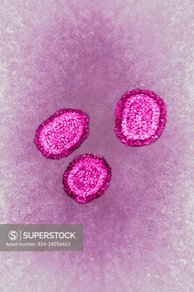Influenza virus (Myxovirus influenzae) from the Orthomyxoviridae family. Viral diameter from 80 to 120 nanometers, taken using transmission electron m...