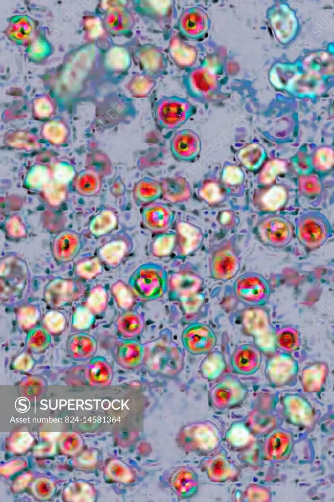 The measles virus (paramyxoviridae from the Morbillivirus family). Image taken from a transmission microscopy view.