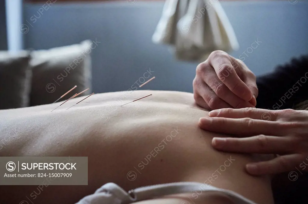 Reportage in a Chinese medicine practice in Lyon, France. Acupuncture session.