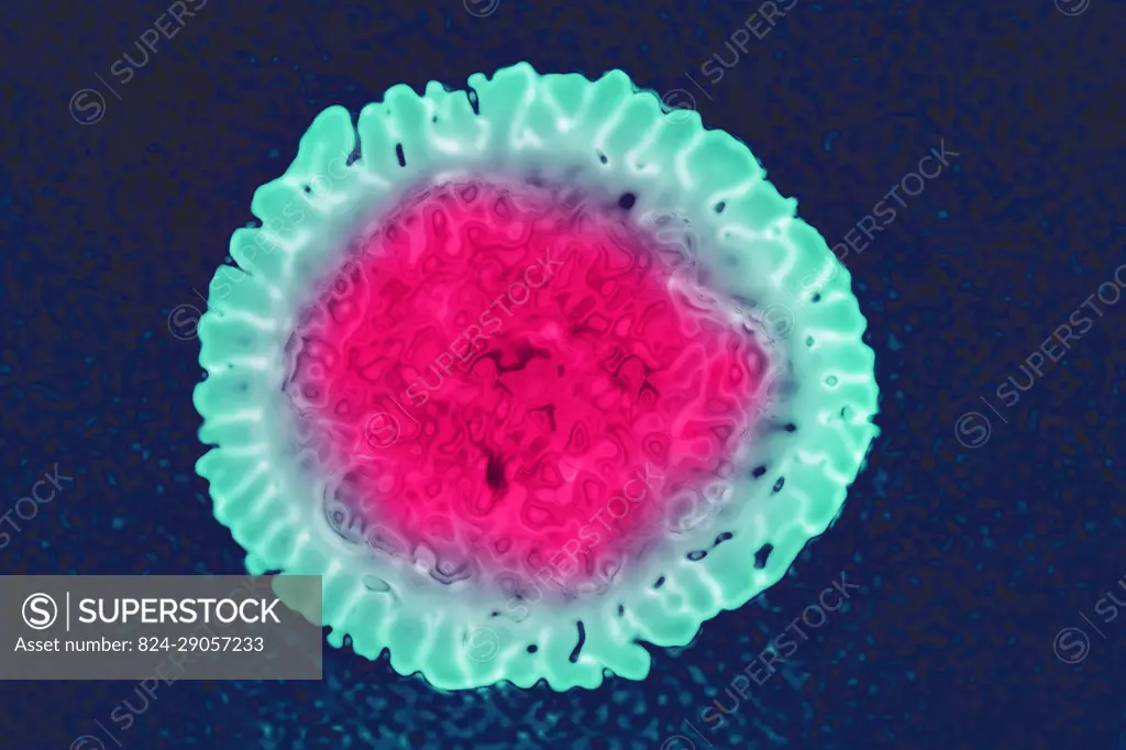 Influenza virus of the Orthomyxoviridae family (respiratory viral infection). Transmission electron microscopy, viral diameter 80 to 120 nanometers.