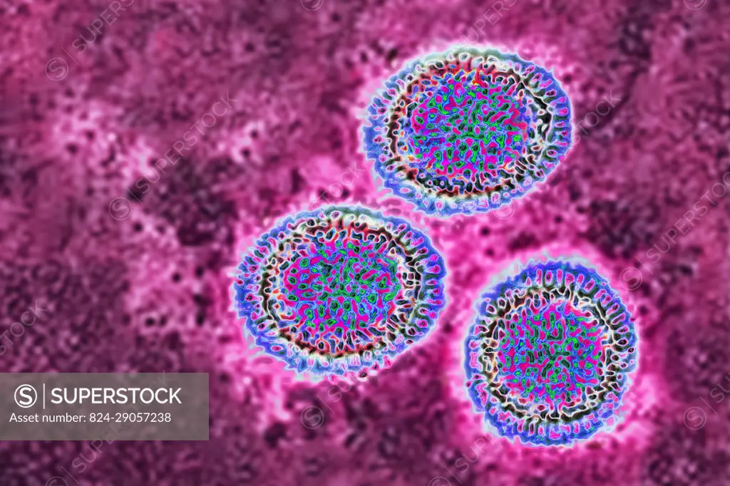 Influenza virus of the Orthomyxoviridae family (respiratory viral infection). Transmission electron microscopy, viral diameter 80 to 120 nanometers.
