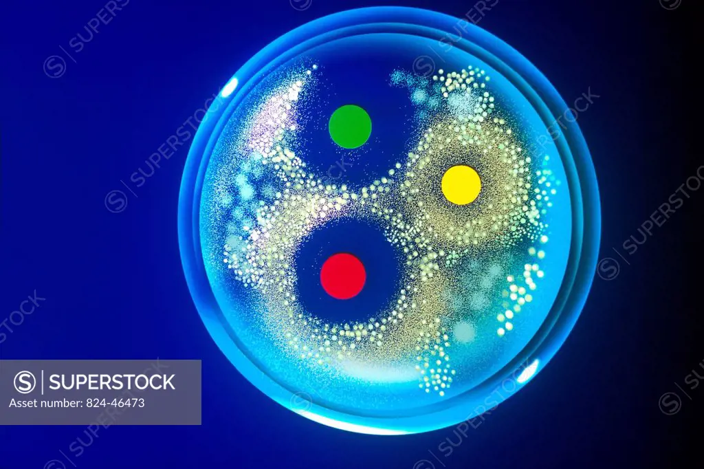Antimicrobial sensitivity testing is a laboratory procedure in which bacteria and antibiotics are place together in order to determine the activity of...