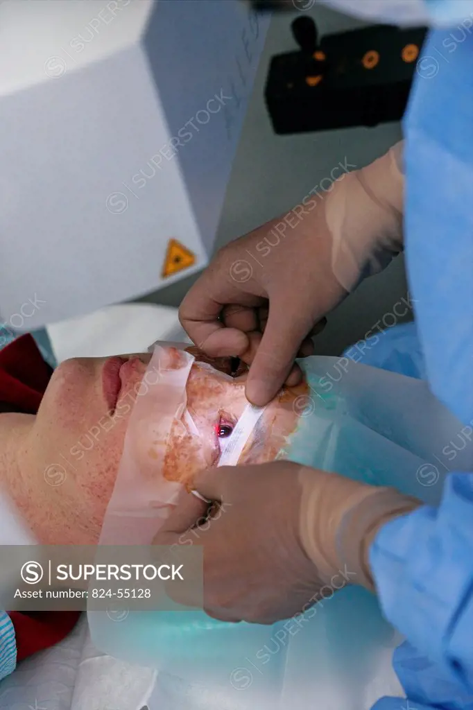 Photo essay at Rouen hospital, France. Laser surgery for nearsightedness. In a first time a corneal disk thin lamelle of cornea is cut up by femtoseco...