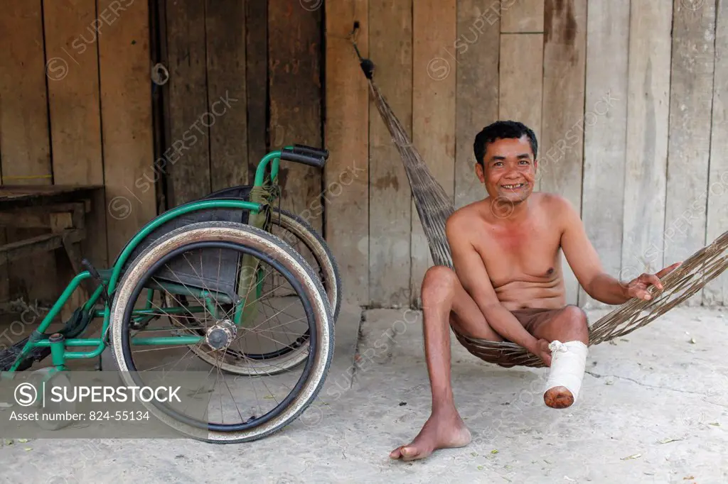 Crippled Cambodian villager.