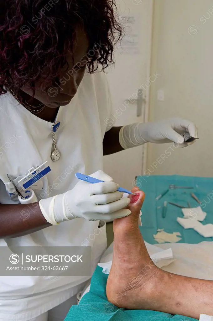 Photo essay in the department of diabetology at Saint_Louis hospital, Paris, France. A nurse caring the diabetic foot.
