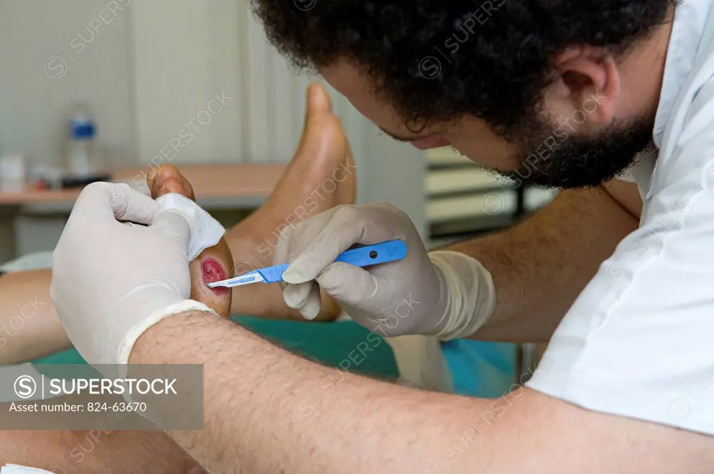 Photo essay in the department of diabetology at Saint_Louis hospital, Paris, France. A male nurse caring the diabetic foot.