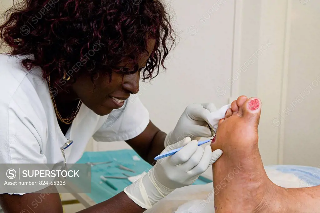 Photo essay in the department of diabetology at Saint_Louis hospital, Paris, France. A nurse caring the diabetic foot.