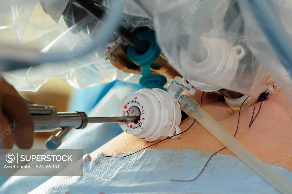 Photo essay at Lyon hospital in France. Department of urology. Prostatectomy. This hospital has a robotic surgical system Da Vinci Surgical System mad...