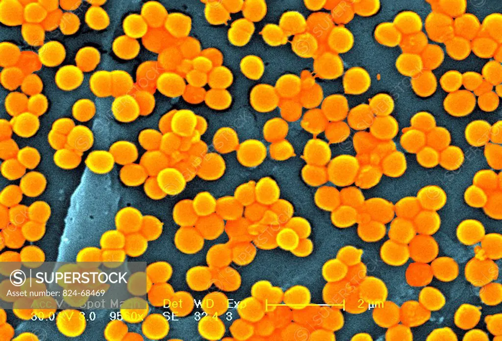 STAPHYLOCOCCUS AUREUS Methicillin_resistant golden staph Staphylococcus aureus MRSA, scanning electron micrograph colorized SEM, x 9560, the line repr...