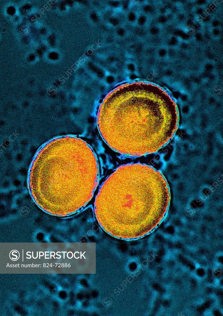 ASCARIS<BR>Roundworm eggs. Roundworms are parasitic intestinal worms which are the causative agent of ascariasis.  Microscopic image (4OOX).