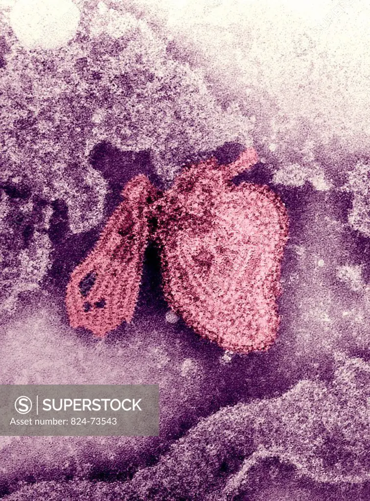 MUMPS VIRUS<BR>Electron micrograph of the Mumps virus.  The mumps virus is a member of the family of Paramyxoviridae, and is enveloped by a helical ri...