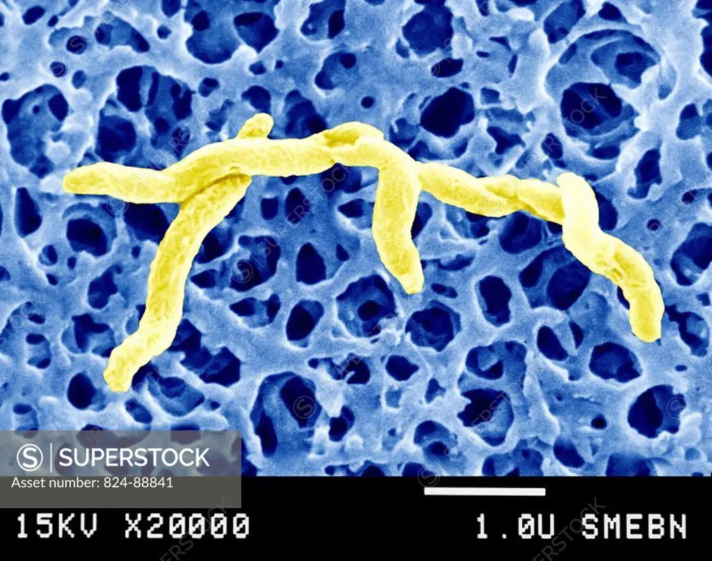CAMPYLOBACTER JEJUNI<BR>Campylobacter is a family of curved Gram-negative bacteria. Several species have been identified. Campylobacter pylori (the ca...