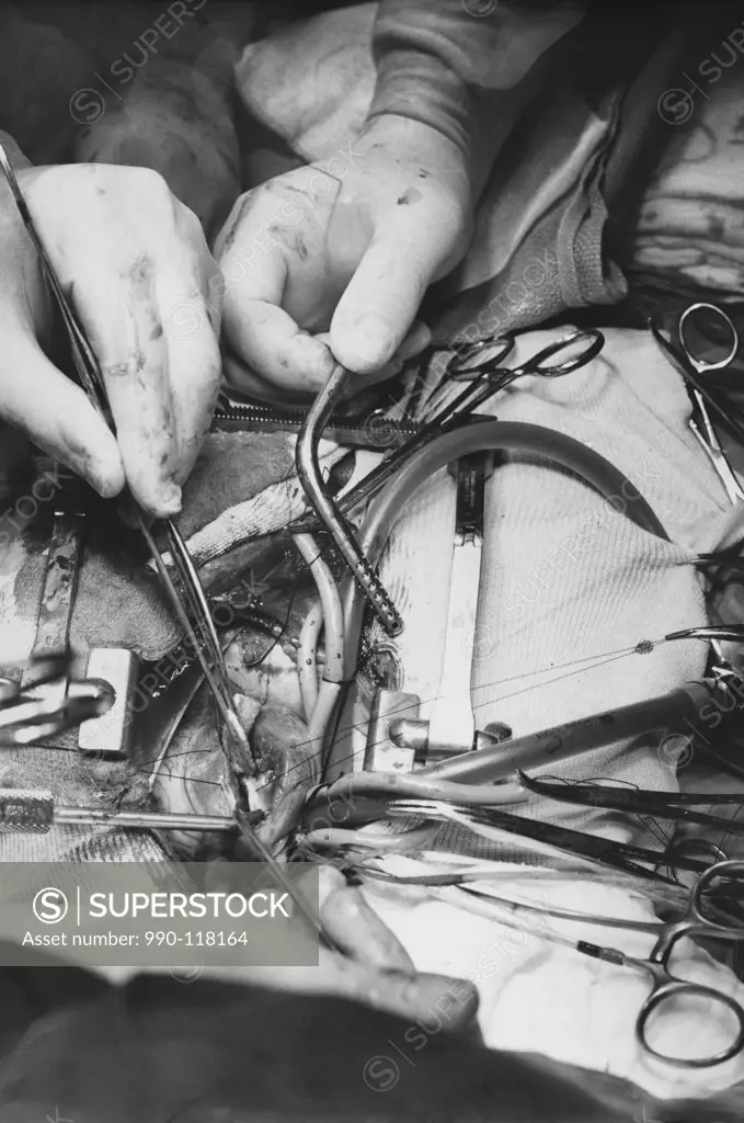 Close-up of surgeons performing open-heart surgery