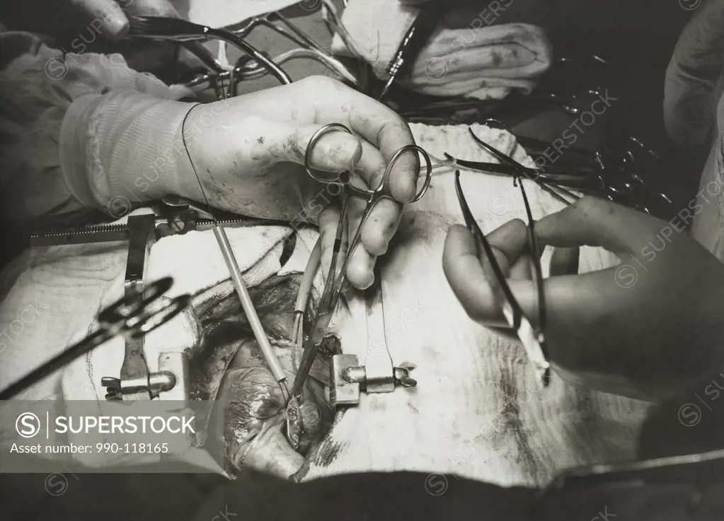 Close-up of surgeon's hands performing open-heart surgery