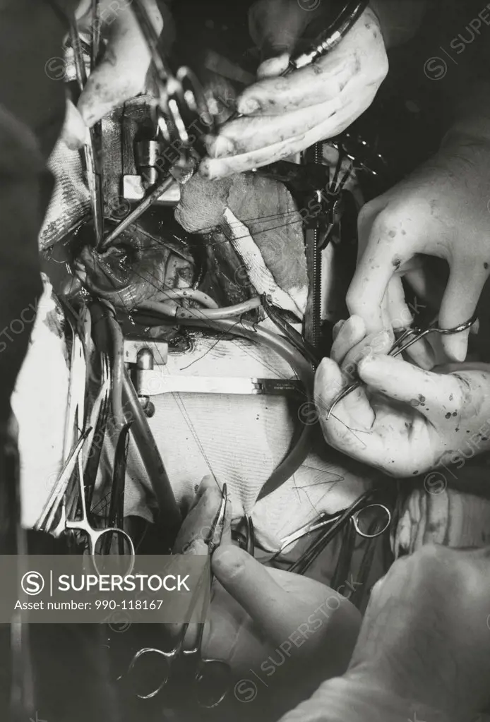 Close-up of surgeon's hands performing open-heart surgery